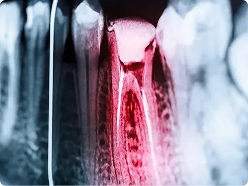 endodonzia bussolengo