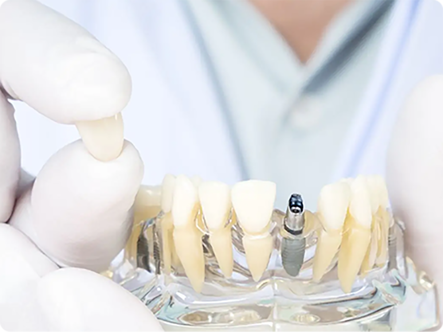 igiene dentale bussolengo