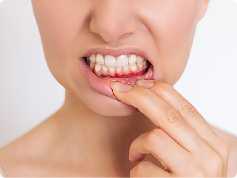 parodontologia gengive bussolengo