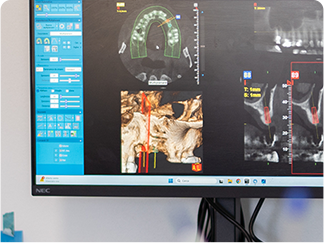 Progettazione digitale del sorriso