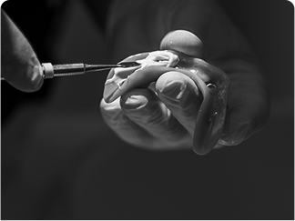 Protesi provvisoria fissa