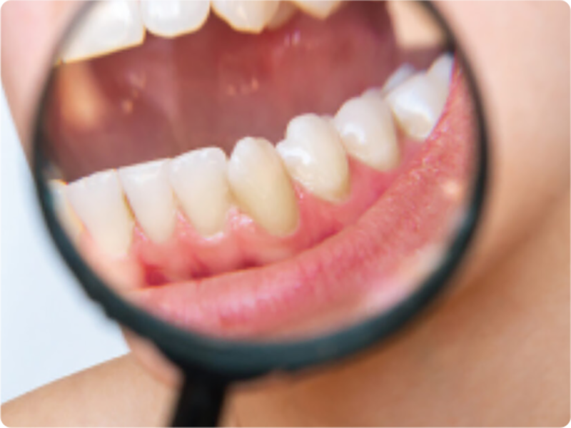 sedute igiene dentale bussolengo