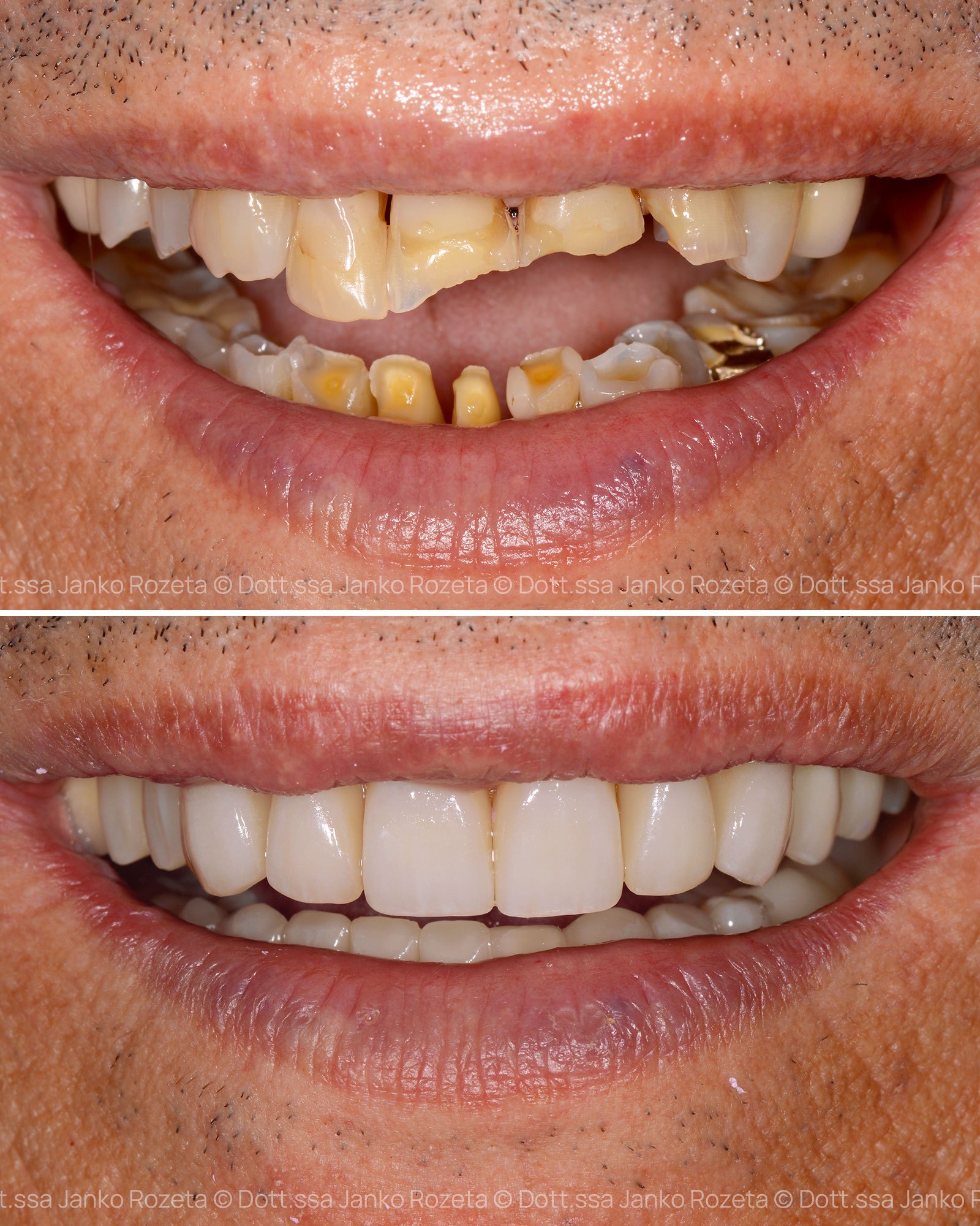 protesi dentale bussolengo