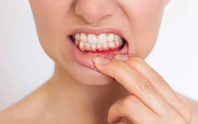 Parodontologia per la salute delle gengive