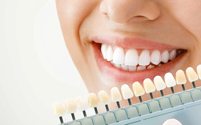 Odontoiatria conservativa ed estetica (faccette, sbiancamento, intarsi)